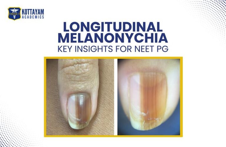 longitudinal melanonchia